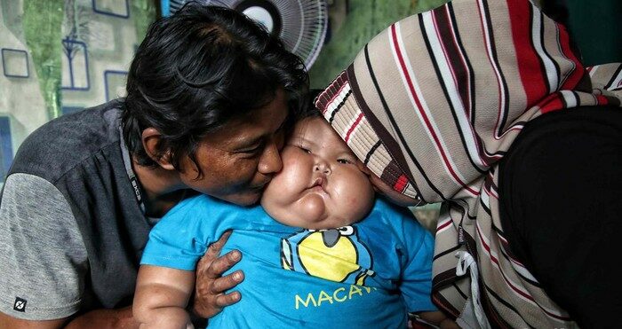 Sosok Kenzie, bayi viral berusia setahun berbobot 27 kg. (Foto: Pradita Utama)