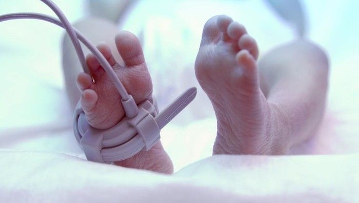 Kronologi meninggalnya bayi yang kepalanya diduga 'dirobek' saat dilahirkan. (Foto ilustrasi: iStock)